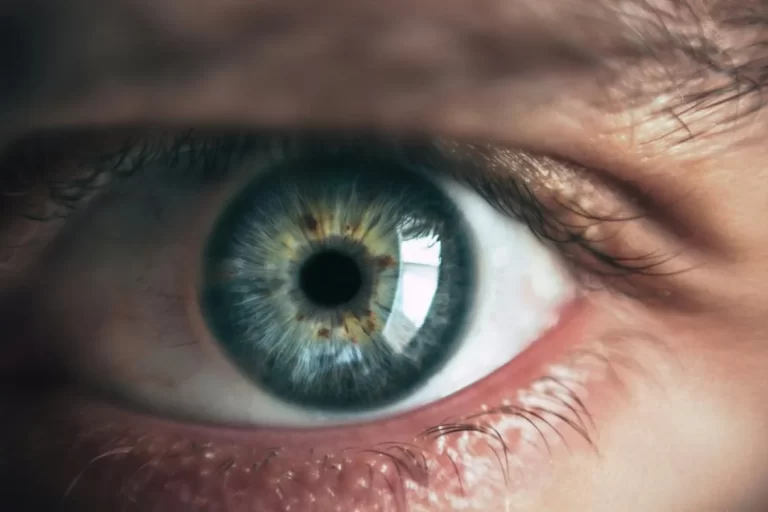 Heterocromia la copii – când este periculoasă și care sunt cauzele apariției