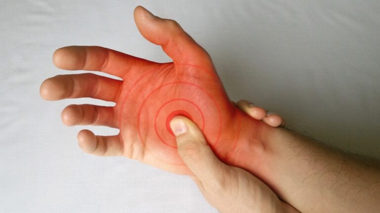 Care sunt cele mai eficiente optiuni de tratament pentru sindromul de tunel carpian?