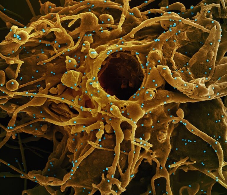 Boli autoimune frecvente: simptome, diagnostic și tratament