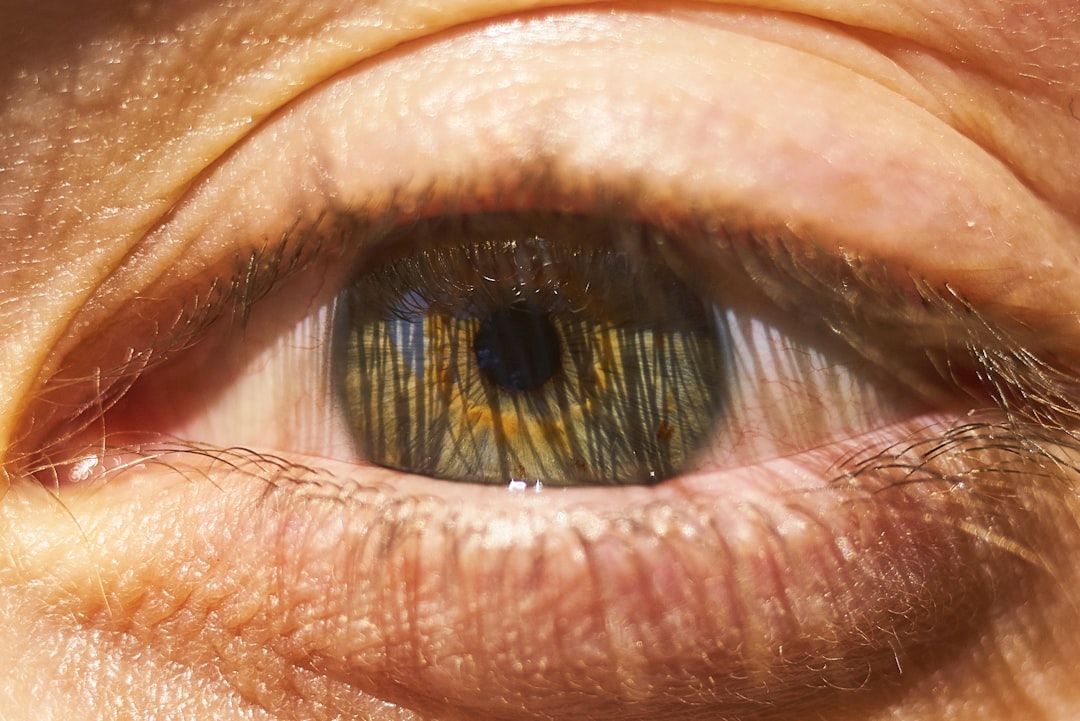 Photo cataract symptoms