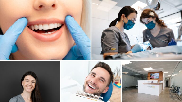 Ce sunt fațetele dentare și cui i se recomandă acest tratament de estetică dentară?