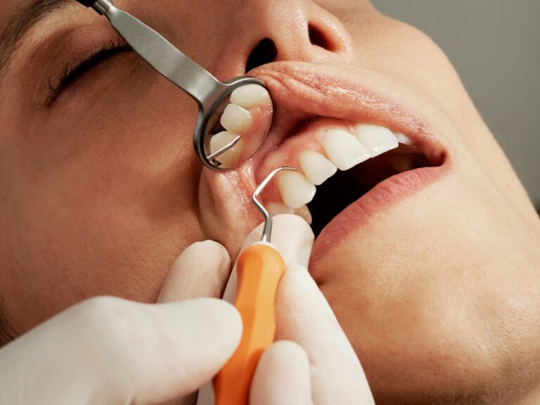 Tot ce trebuie să știi despre sănătatea dentară