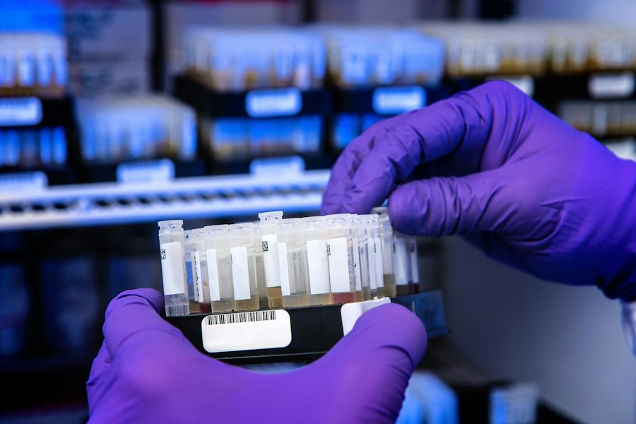 early disease detection screening